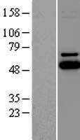 UBE2Q1 Human Over-expression Lysates NM_017582