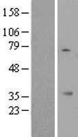 MIOX Human Over-expression Lysates NM_017584