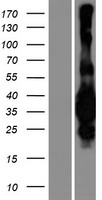 ls055588 med29 human over expression lysates nm 017592 wb testing 1