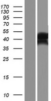 OTUD5 Human Over-expression Lysates NM_001136159