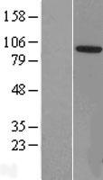 ZCCHC8 Human Over-expression Lysates NM_017612