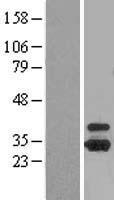 OTUB1 Human Over-expression Lysates NM_017670