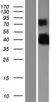 Protor 1 (PRR5) Human Over-expression Lysates NM_001017529