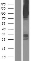ASAP3 Human Over-expression Lysates NM_017707