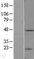TASP1 Human Over-expression Lysates NM_017714