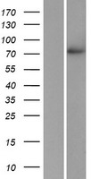 POMGNT1 Human Over-expression Lysates NM_017739