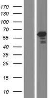 TBC1D22B Human Over-expression Lysates NM_017772