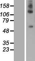 DEPDC1 Human Over-expression Lysates NM_017779