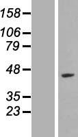 LYAR Human Over-expression Lysates NM_001145725