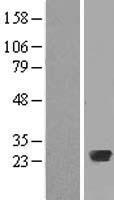 RAB20 Human Over-expression Lysates NM_017817