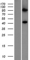 ls055650 pigv human over expression lysates nm 017837 wb testing 1