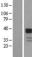 RNF126 Human Over-expression Lysates NM_017876