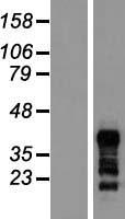 RNF126 Human Over-expression Lysates NM_194460