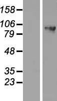 DDX27 Human Over-expression Lysates NM_017895