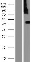 C9orf86 (RABL6) Human Over-expression Lysates NM_001173989
