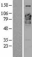 C9orf86 (RABL6) Human Over-expression Lysates NM_024718