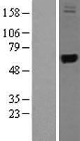 TRMT1 (TRMU) Human Over-expression Lysates NM_018006