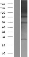 PACS1 Human Over-expression Lysates NM_018026