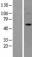 NSUN5 Human Over-expression Lysates NM_148956