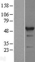 ls055696 rbm22 human over expression lysates nm 018047 wb testing 1