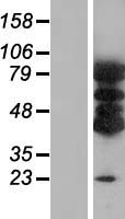 VAC14 Human Over-expression Lysates NM_018052
