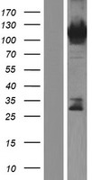 ls055698 radil human over expression lysates nm 018059 wb testing 1
