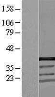 ls055702 yju2 human over expression lysates nm 018074 wb testing 1