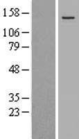 WDR11 Human Over-expression Lysates NM_018117