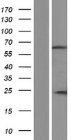 IQCC Human Over-expression Lysates NM_001160042