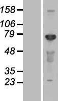 CEP72 Human Over-expression Lysates NM_018140