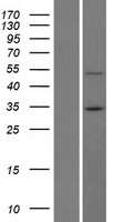 BTBD7 Human Over-expression Lysates NM_018167