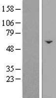 ls055731 fam222b human over expression lysates nm 018182 wb testing 2