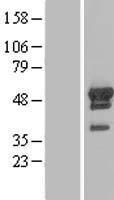 ARFGAP1 Human Over-expression Lysates NM_175609