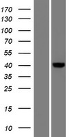CARKD (NAXD) Human Over-expression Lysates NM_018210