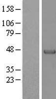 Parvin alpha (PARVA) Human Over-expression Lysates NM_018222