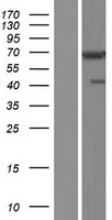 ls055743 chfr human over expression lysates nm 001161347 wb testing 2