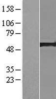 AP5M1 Human Over-expression Lysates NM_018229