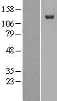 NUP133 Human Over-expression Lysates NM_018230