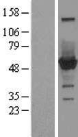 CNDP2 Human Over-expression Lysates NM_018235