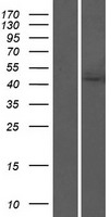 ls055750 acylglycerol kinase agk human over expression lysates nm 018238 wb testing 1