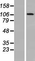OGDHL Human Over-expression Lysates NM_018245