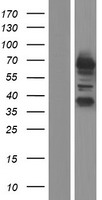 ls055758 rcor3 human over expression lysates nm 001136223 wb testing 2