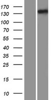 ls055764 ift122 human over expression lysates nm 052989 wb testing 2