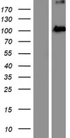 EXOC2 Human Over-expression Lysates NM_018303