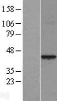 PRR11 Human Over-expression Lysates NM_018304