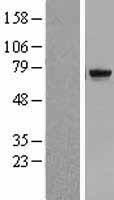 TDP1 Human Over-expression Lysates NM_001008744
