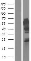 MINDY1 Human Over-expression Lysates NM_018379
