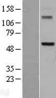 DDX28 Human Over-expression Lysates NM_018380