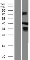 MBNL3 Human Over-expression Lysates NM_001170701