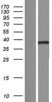 MBNL3 Human Over-expression Lysates NM_001170702